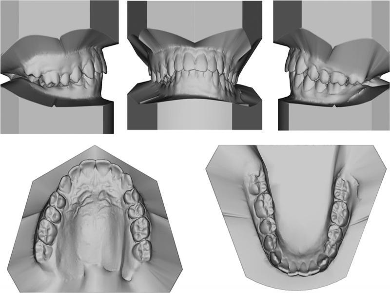 Pre-treatment models.