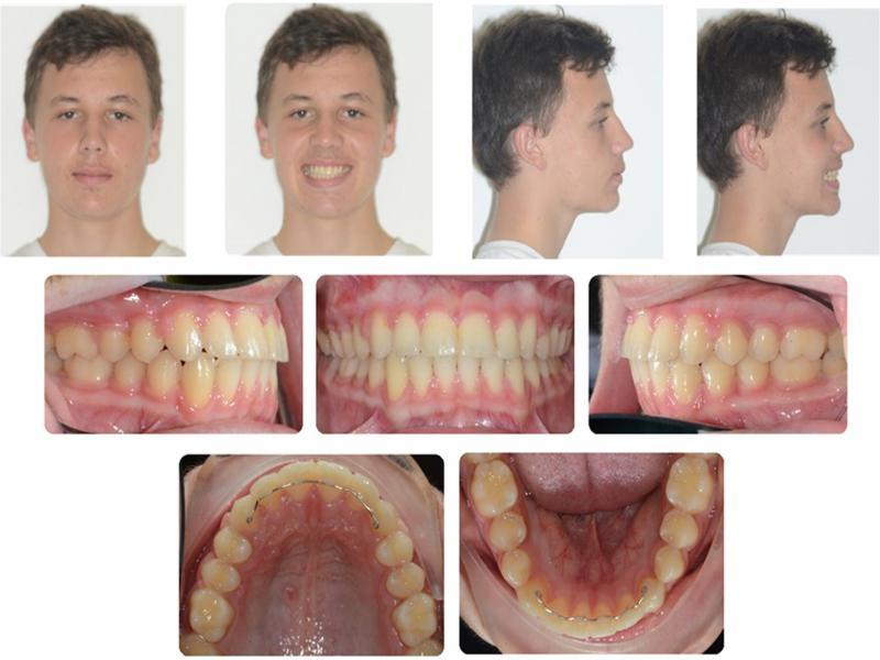 Post-treatment photographs.