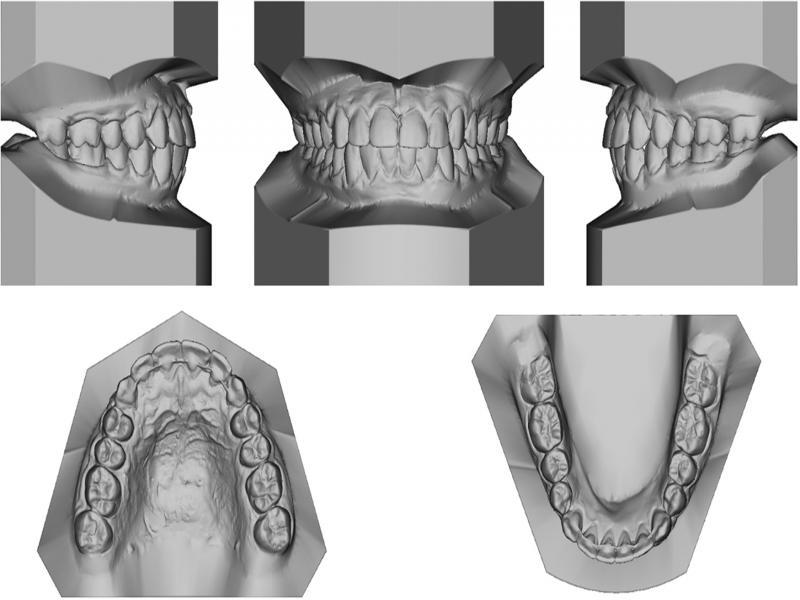 Post-treatment models.