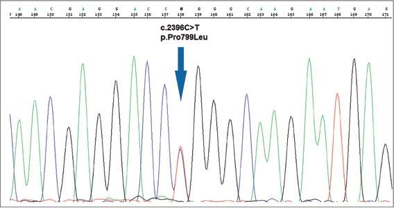 The c.2396C>T; p.Pro799Leu (P799L) mutation in the TPRV4 gene.