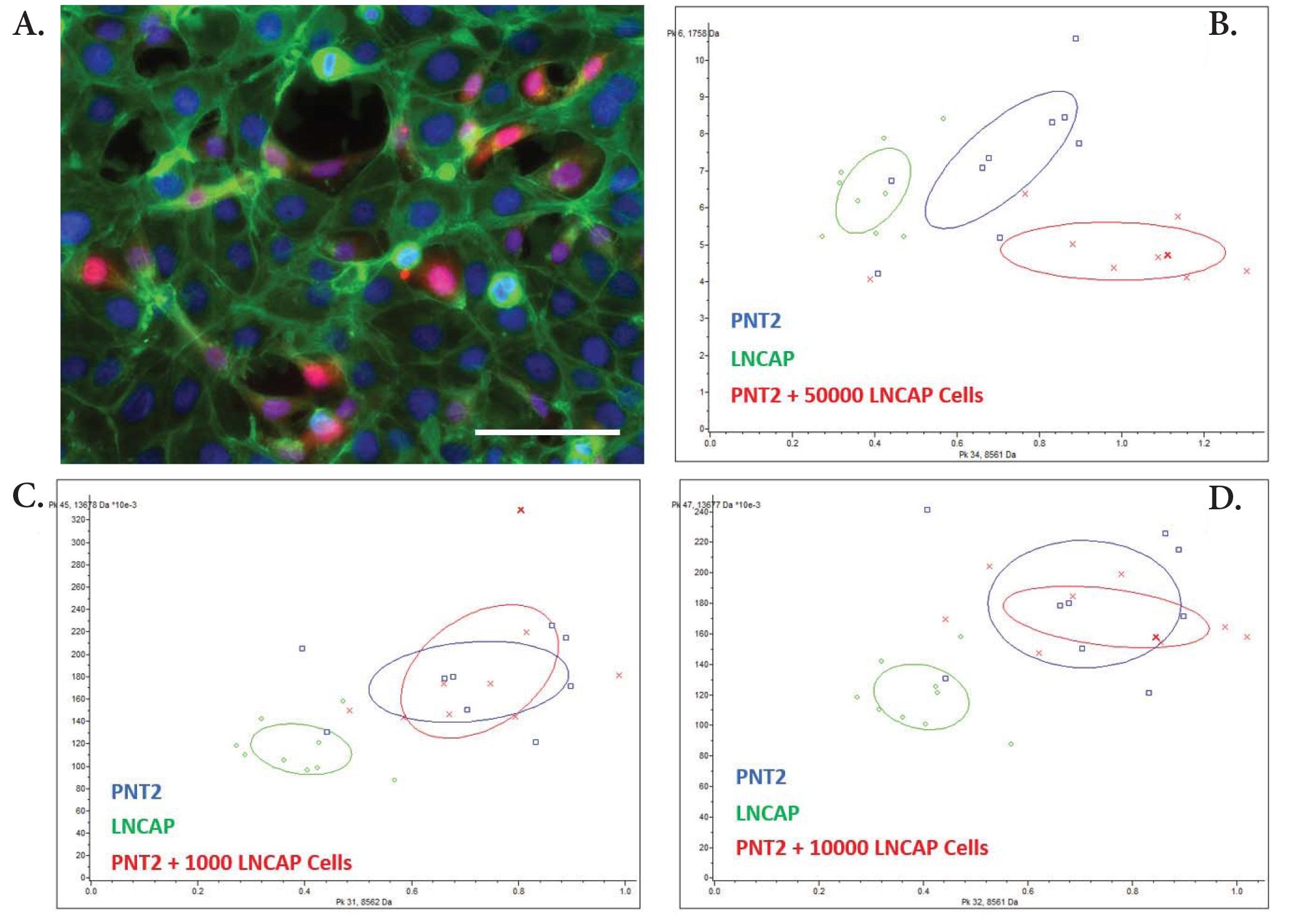 PNT2 cells co-cultured with LNCaP cells. A. Mixed population of non-cancerous (PNT2) and cancerous (LNCaP) prostatic cells. Confocal image of LNCaP labelled with CellTracker™_Green (here in red) on a PNT2 cells layer (here in green) cultured for 72h. Blue: Hoechst; Green Phalloidin; Red: LNCaP labelled with CellTracker™_Green. False colors are used for better visibility. Bar : 100 μm. B. 2D peak distribution of MALDI profiling analysis of PNT2 cells co-cultured with LNCaP cells.