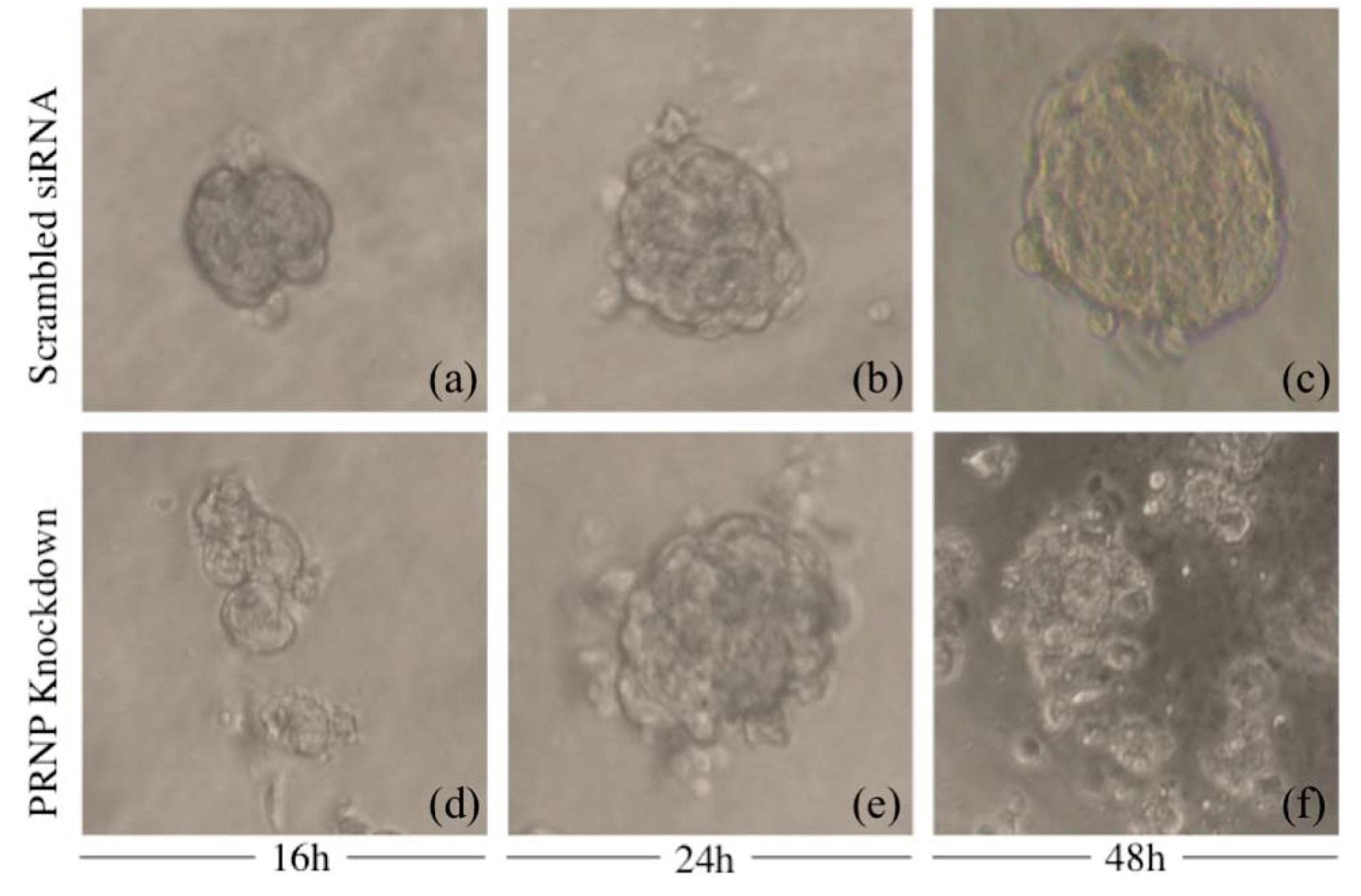 Spheroid formation assay. Representative images showing Spheroids’ growth obtained from HUVEC PrPKD and scrambled siRNAs cells at 16, 24 and 48 h. Images were taken with a 20X objective.