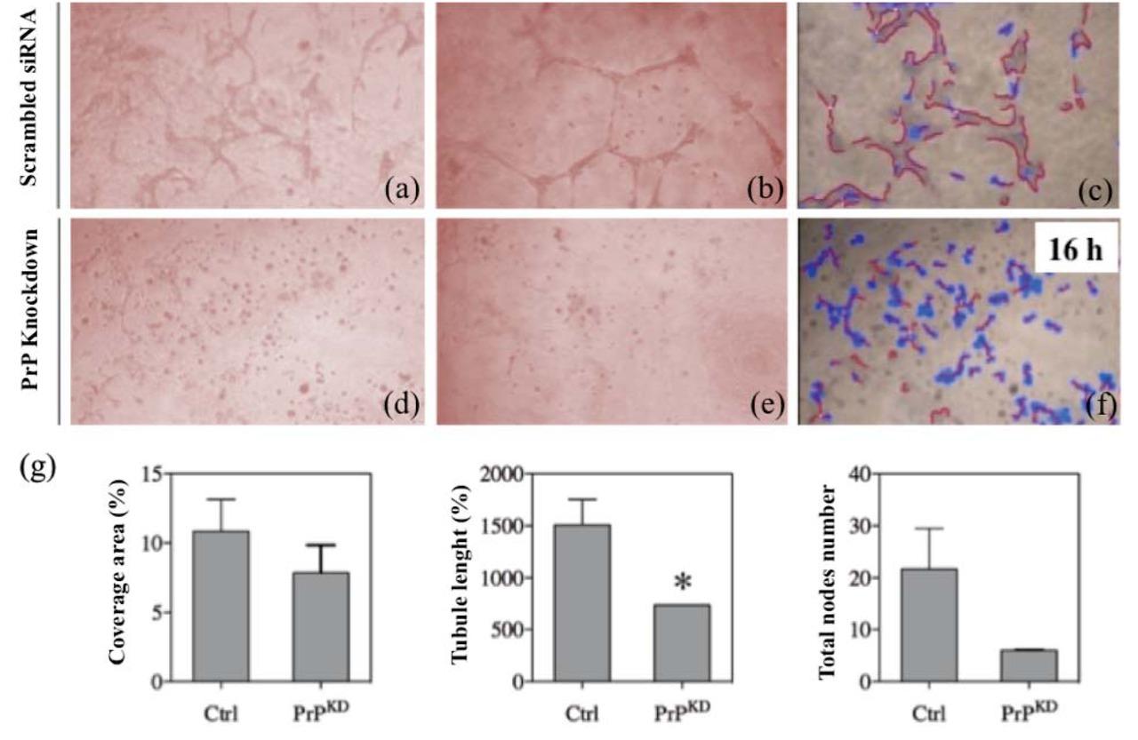 VEGF-induced tubulogenesis assay in Matrigel. HUVEC control (a-b) and PrPKD (d-e) seeded on Matrigel and stimulated for 16h. Images (c) and (f ), relative to network analysis are performed by WimTube software (Wimasis GmbH, Germany). Histograms (g) are respectively referred to coverage area, tubules and knots; data reported are related to statistical analysis of images acquired in three independent experiments (* p <0.05).