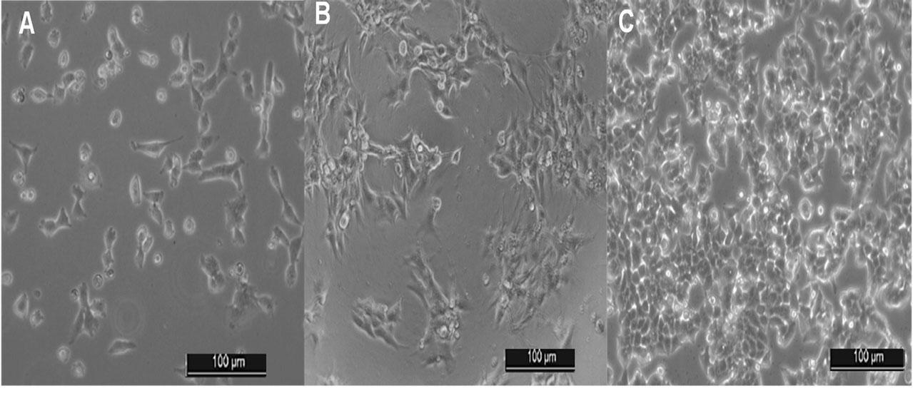 Cancer model cell lines: A) UMUC-3, B) SK-MEL30 C) MCF-7 (Invert, phase contrast light microscope)