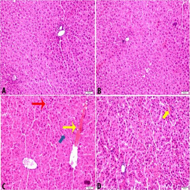 Light microscopy of liver tissue stained with H&E in experimental groups. (A) Control group (n=8) and (B) CLQ group (n=8), normal liver were observed; (C) ADR group (n=8), hemorrhage (yellow arrow), necrotic hepatocytes (red arrow), vacuolized hepatocytes (blue arrow), and irregular hepatocytes cords were observed; and (D) ADR+CLQ group, near to normal liver tissue were observed except for small hemorrhagic regions (yellow arrow); Scala bar: 50 μ. Magnification x200. Abbreviations: ADR, Adriamycin; CLQ, Chloroquine.