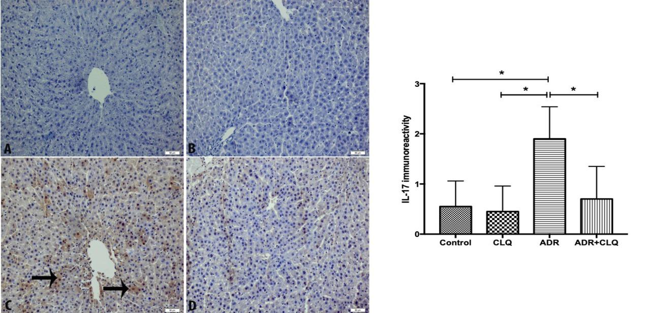 Immunohistochemical staining of IL-17 in the liver tissues and statistical analysis of the score of immunohistochemical staining in the experimental groups. (A) Control (n=8) and (B) CLQ (n=8) showed weak IL-17 immunostaining in the liver tissue sections; (C) ADR (n=8) group, IL-17 expression increased in the liver tissue. (D) ADR+CLQ (n=8) IL-17 expression was significantly decreased when compared to the ADR group. Arrows show the IL-17 immunopositive cells. Graph shows the statistical analysis of the score of immunohistochemical staining according to the following criteria: 0, no staining; 1, weak immunoreactivity; 2, moderate immunoreactivity; 3, strong immunoreactivity. Scala bar: 50 μ. Magnification x200. Abbreviations: ADR, Adriamycin; CLQ, Chloroquine.
