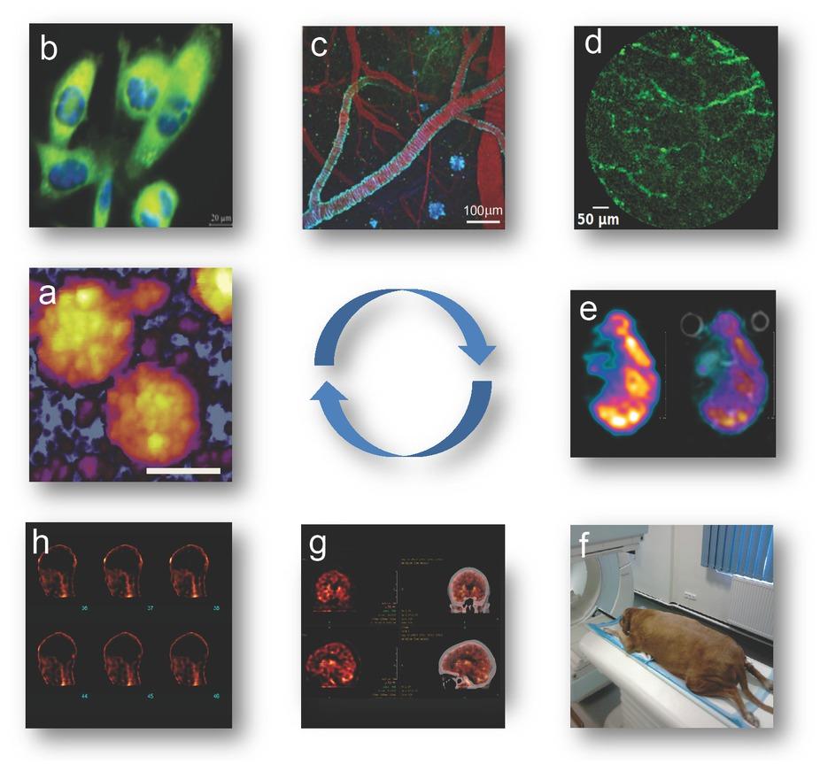 The concept of multi-scale imaging from molecules-to-mose-to-man (”3M”). Logical elements of the 3M pipeline are indicated clockwise, from a through h. a. Height-contrast AFM image of substrate-adsorbed SARS-CoV-2 virions displaying their surface proteins (scale bar, 100 nm), b. Fluorescence images of glioma cells loaded with a fluorescent dye (NBD) and Hoechst-blue for nuclear staining, c. In vivo multiphoton fluorescence image of a mouse brain with green fluorescent protein (GFP)-expressing neurons. Texas Red-labeled dextran in red fluorescence was used as a vascular marker, blue fluorescence indicates perivascular amyloid. d. NBD-loaded liposome vascular contrast in a live animal glioma xenograft measured by using confocal fiber optic fluorescence microscopy. e. 99mTc-hydroxymethylydene-paraamino-oxime (HMPAO) perfusion SPECT brain image coupled to gradient echo MRI in a mouse stroke model. f. Experimental setup of a living dog SPECT imaging study. g. HMPAO human brain perfusion SPECT/ CT. h. Human bone scan using 99mTc-labeled bisphosphonate.