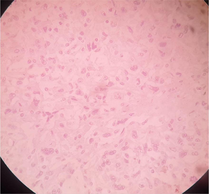 ER stain negative in high power (×40).