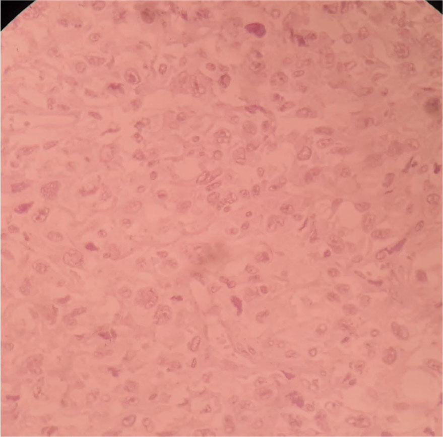 PR stain negative in high power (×40).