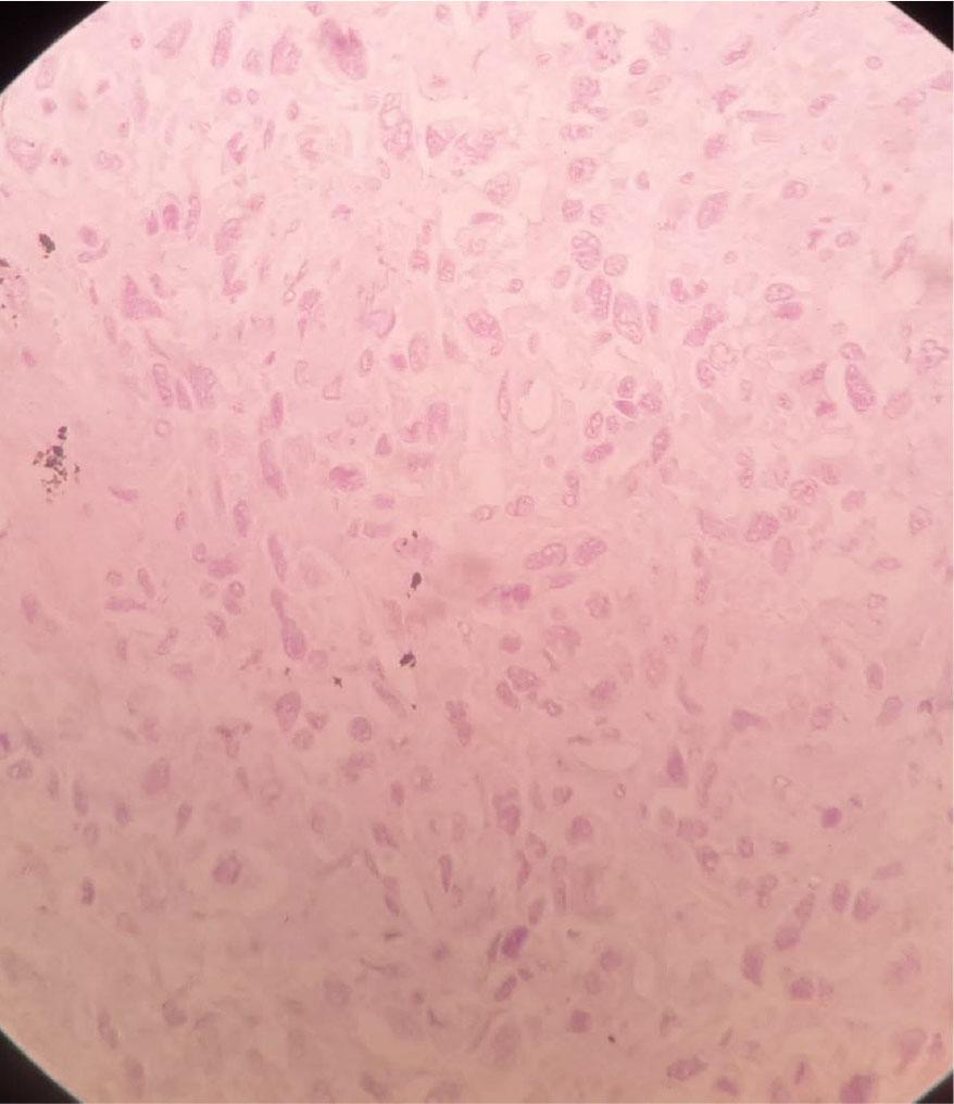 HER2 stain negative in high power (×40).