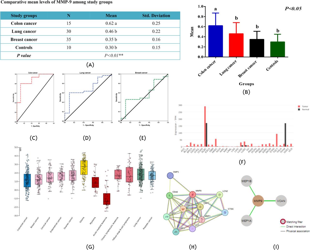 Expression and protein analysis of MMP9. (A) Means of the study groups when compared using the Duncan test; a,b Significant differences (p < 0.05). (B) Comparative mean levels of MMP9 among study groups. (C) Sensitivity and specificity graph of colon cancer. (D) Sensitivity and specificity graph of lung cancer. (E) Sensitivity and specificity graph of breast cancer. (F) Differential gene expression of MMP9 in LUAD, COAD, and BRCA tumors. (G) Protein concentrations of MMP9 in each cancer. (H) PPI analysis through STRING. (I) PPI analysis through protein atlas.