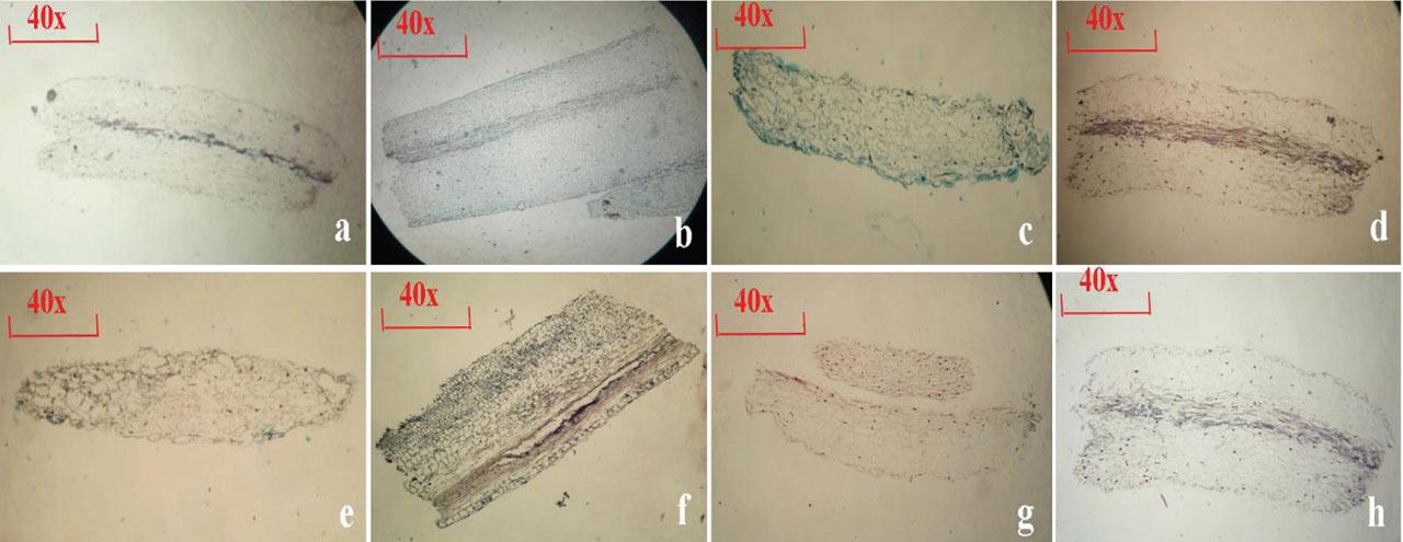 Filament vertical sections: (A) ‘3-1’, (B) ‘5-4’, (C) ‘5-35’, (D) ‘0-0.2’, (E) ‘5-21’, (F) ‘3-12’, (G) ‘Pollyanna’ and (H) ‘Sorbonne’.