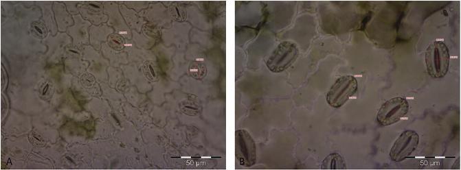 Stomal diameter and length in diploid (A) and tetraploid (B) plant leaves (magnified 400×).
