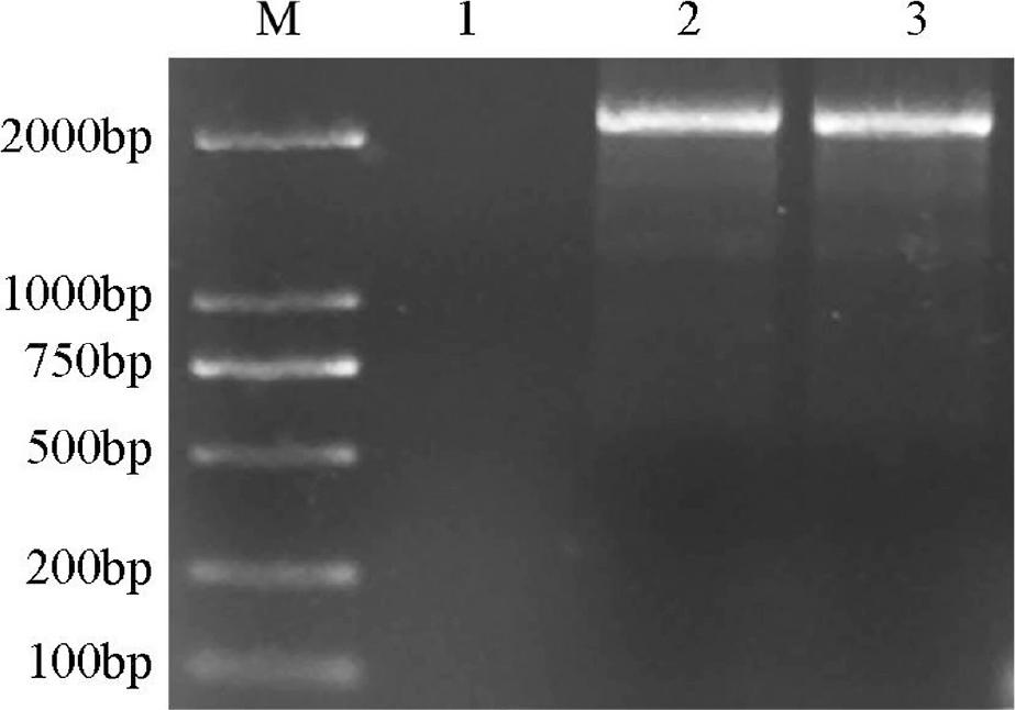 Agarose gel electrophoresis of the polymerase chain reaction product. The amplification product of LiDXS2. (M) DL2000 DNA marker. (1) Negative control, (2) and (3) LiDXS2.