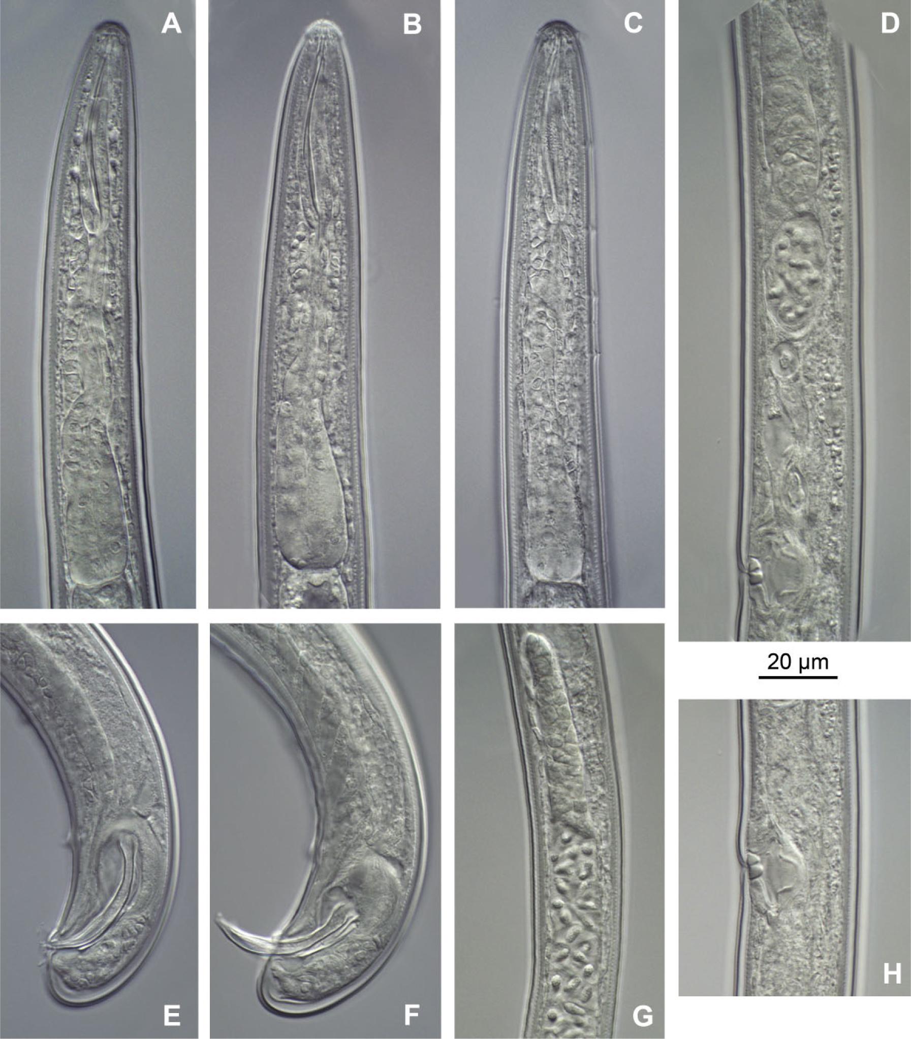 Photomicrographs of Trichodorus similisSeinhorst, 1963, female and male.A – C: Anterior region of female (A, B) and male (C); D: Female reproductive system (anterior genital branch); E, F: Posterior body region (male tail and spicules); G: Male gonad; H: Vagina.