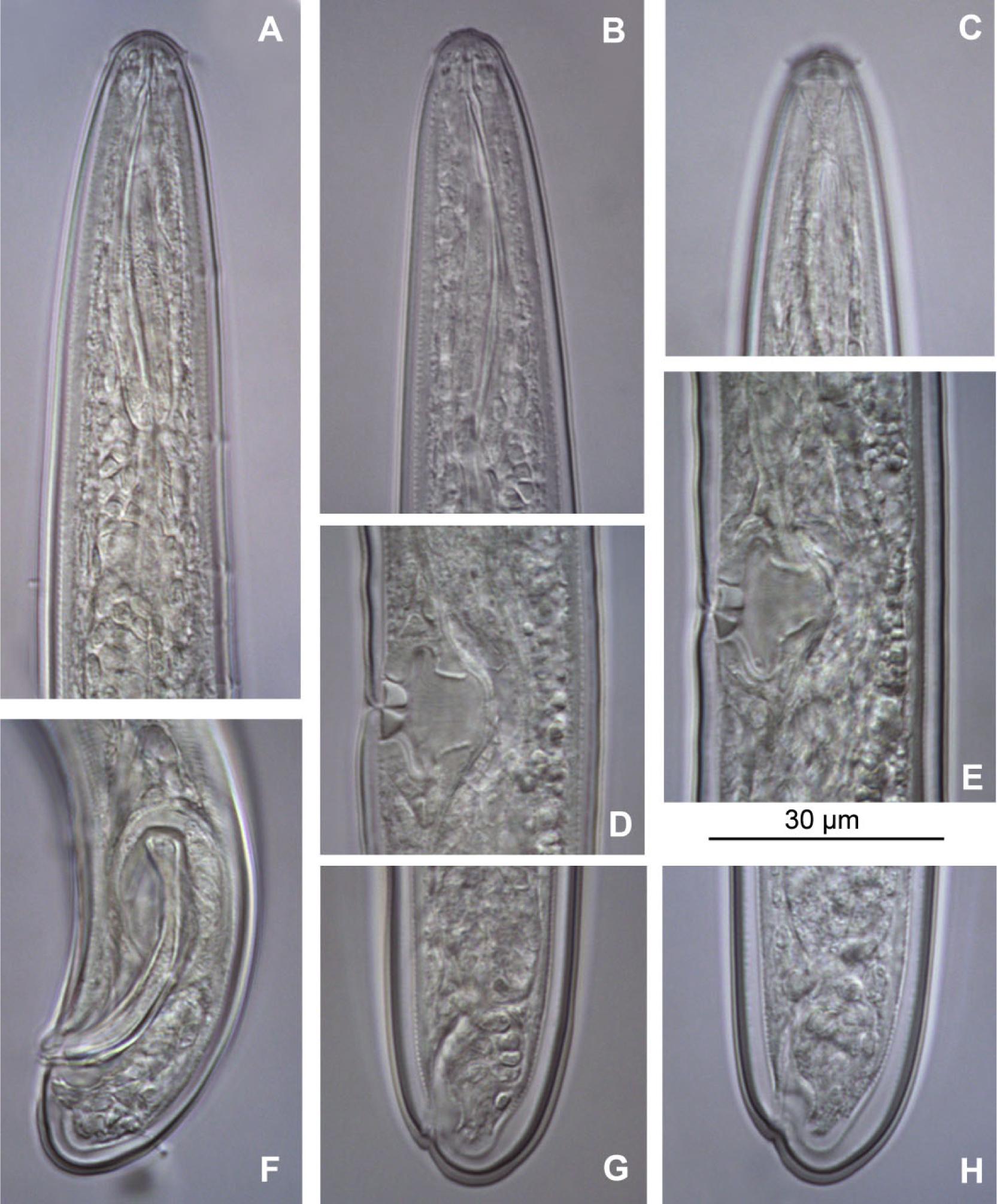 Photomicrographs of Trichodorus similisSeinhorst, 1963, female and male.A: Lips, onchiostyle and ventromedian pores of male; B: Lip and onchiostyle region (female); C: Amphid; D, E – Variations in vagina; F: Male tail and spicules; G, H: Variations in female tail.