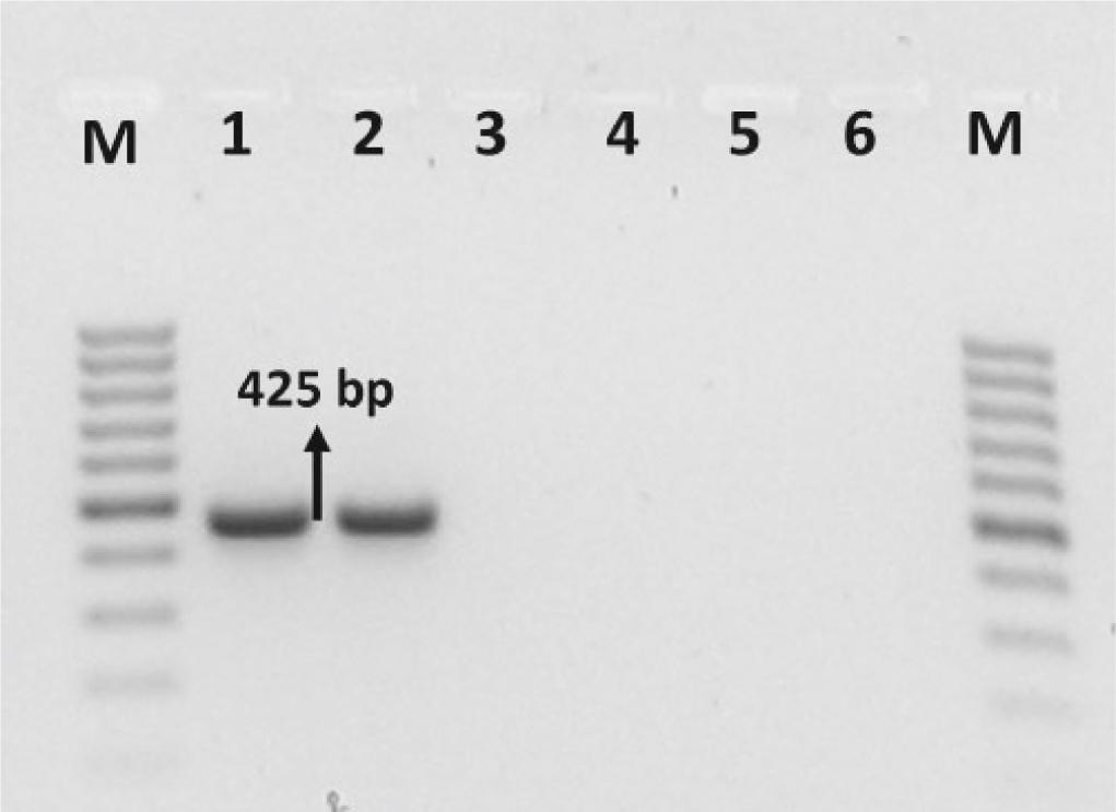 Electrophoresis of the amplified products of Trichodorus similis: lane M – 100bp DNA ladder (Fermentas); lane 1 – female1; lane 2 – female2; lane 3 – T. pakistanensis; lane 4 – T. variopapillatus 4; lane 5 – T. viruliferus and lane 6: negative control.