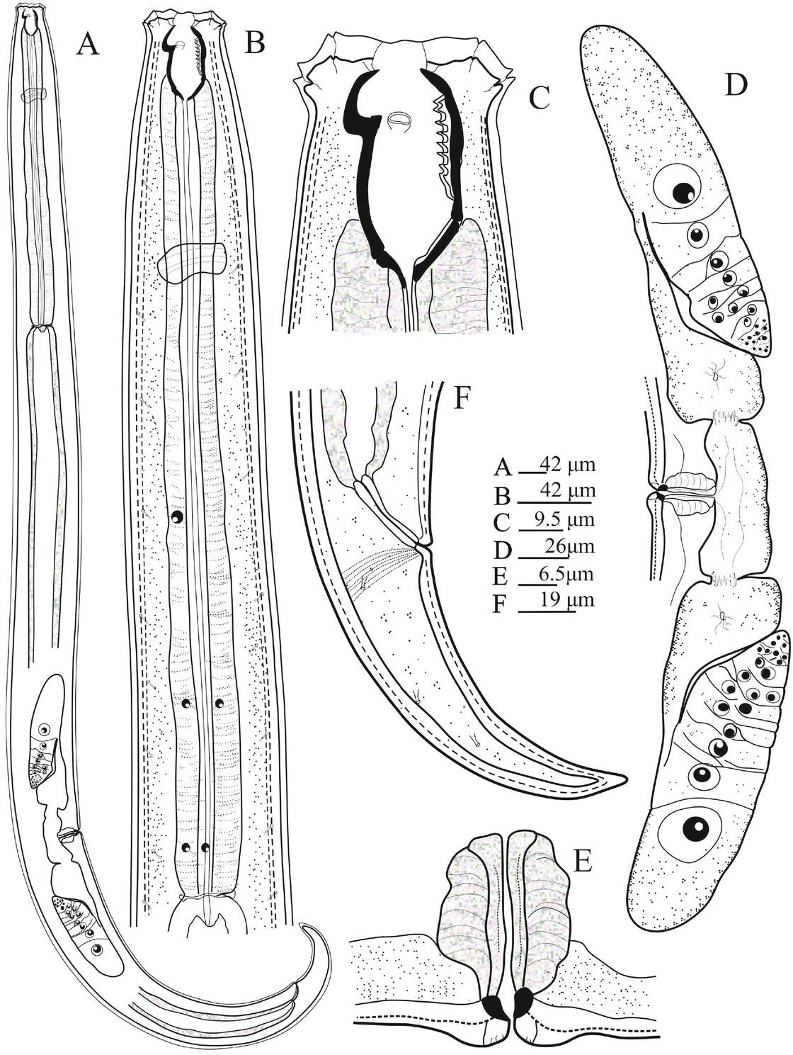 Prionchulus girchi sp. n. A: Entire female body; B: Neck region; C: Anterior end; D: Female reproductive system; E: vaginal region; F: Caudal region.