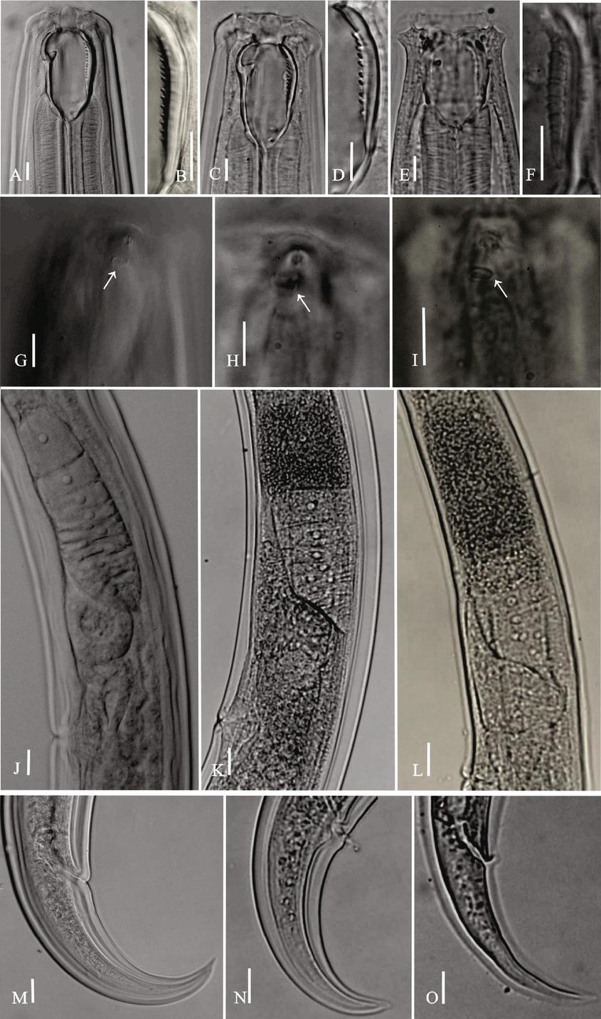 A, B, G, J, M: Prionchulus fagi Zell, 1985. A: Anterior region; B: Sub ventral denticles; G: Amphidial aperture, J: Anterior genital branch, M: Caudal region, C, D, H, K, N: P. muscorum (Dujardin, 1845) Wu & Hopperli, 1929. C: Anterior region; D: Sub ventral denticles; H: Amphidial aperture, K: Anterior genital branch, N: Caudal region, E, F, I, L, O: P. girchi sp. nov. E: Anterior region; F: Sub ventral denticles; I: Amphidial aperture, L: Anterior genital branch, O: Caudal region. (Scale bar: A-I=10 μm; J-O=20 μm.)