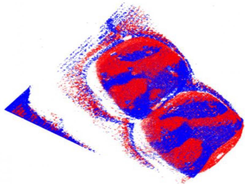 Tooth Model Registration Results