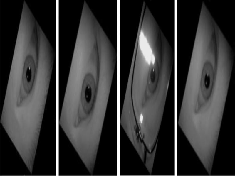 Treatment diagram of the sample rotated by 120°around the eye