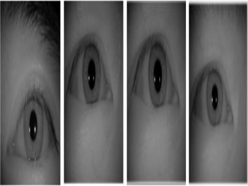 Diagram of 000L partial eye sample
