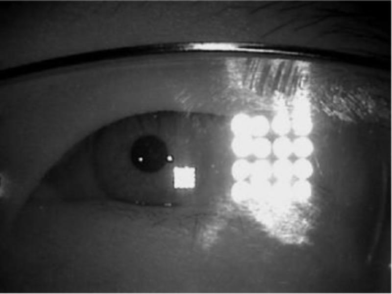 Specular interference around the eye sample