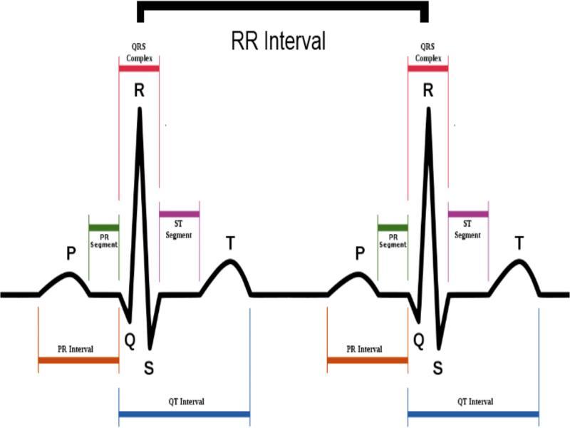 The illustration of QRS complex in an ECG signal.