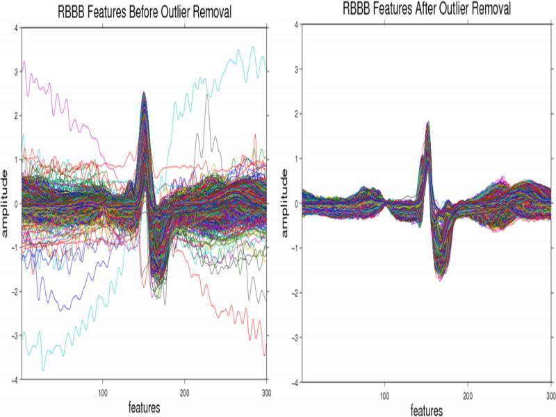 Beat features before and after outlier removal using IQR.