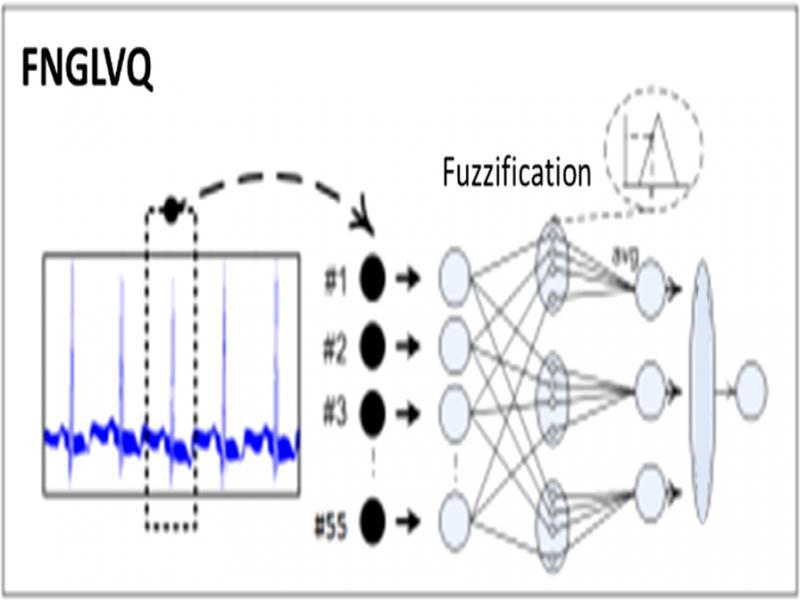 FNGLVQ architecture (Setiawan et al., 2011).