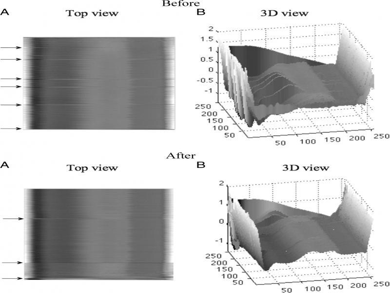 The ECG data before and after the beat reordering method.