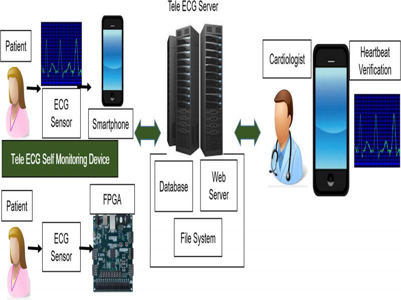 The architecture of Tele-ECG.