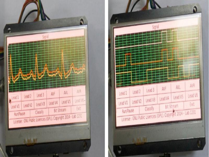 Multi-lead and single-lead ECG machines.