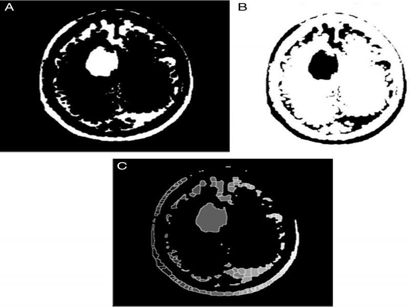 Processing (A) Thresholding, (B) Complement of image, (C) Image after watershed segmentation.