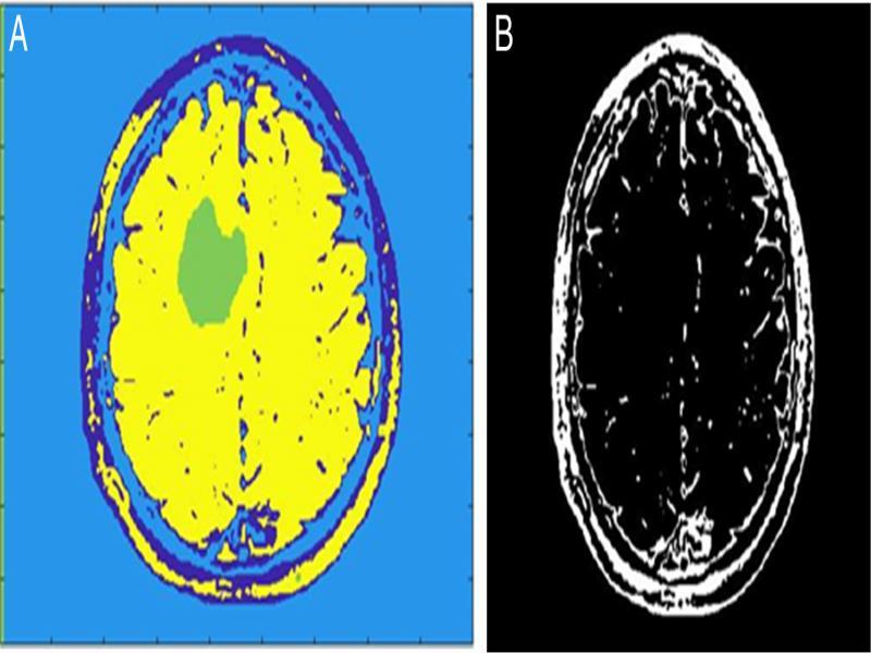 Post-processing (A) Image with four different coloured clusters superimposed after K-Means clustering and (B) Image after MSER detection.