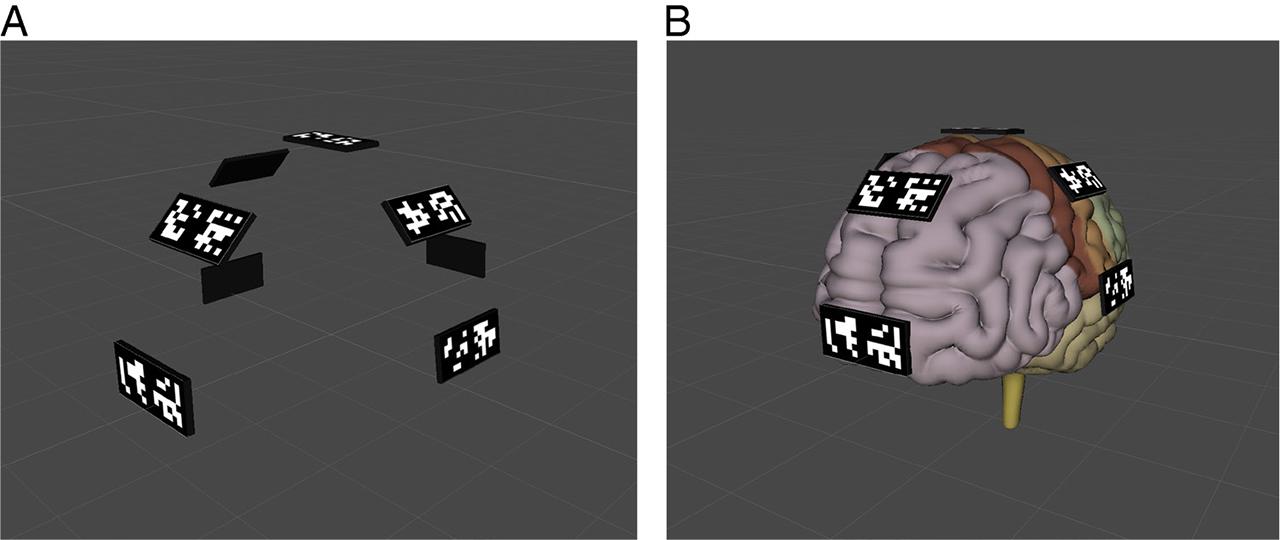 Perspective view of the virtual brain model. (a) Marker (size: 5 × 2.5 cm.) positions in virtual space. (b) Placement of the markers on the virtual brain.