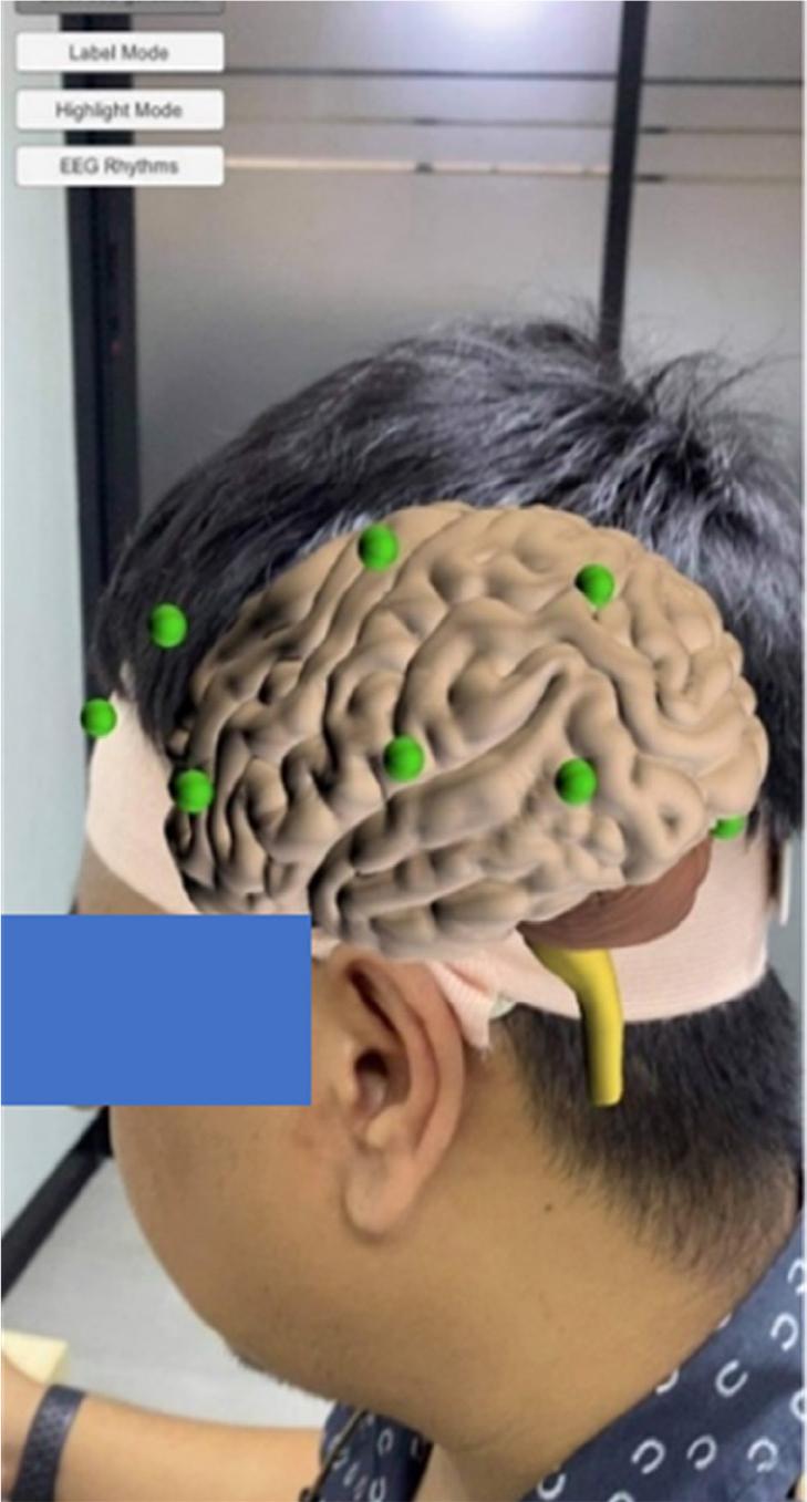 Example of the use of the proposed system with an actual human head.