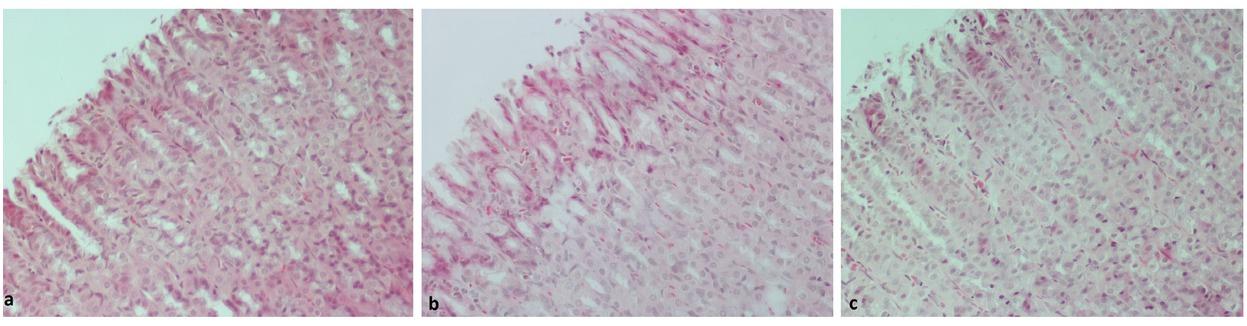 Gastric mucosa sections. HE x 200. Mucosal changes in: a. Chios mastic group: minimal hyperaemia and oedema, rare inflammatory cells, b. omeprazole group: mild hyperemia and oedema, minor deposits of inflammatory cells c. control: more extensive hyperemia and oedema and deposits of inflammatory cells, moderate hemorrhagic infiltration and pronounced loss of epithelial cells.