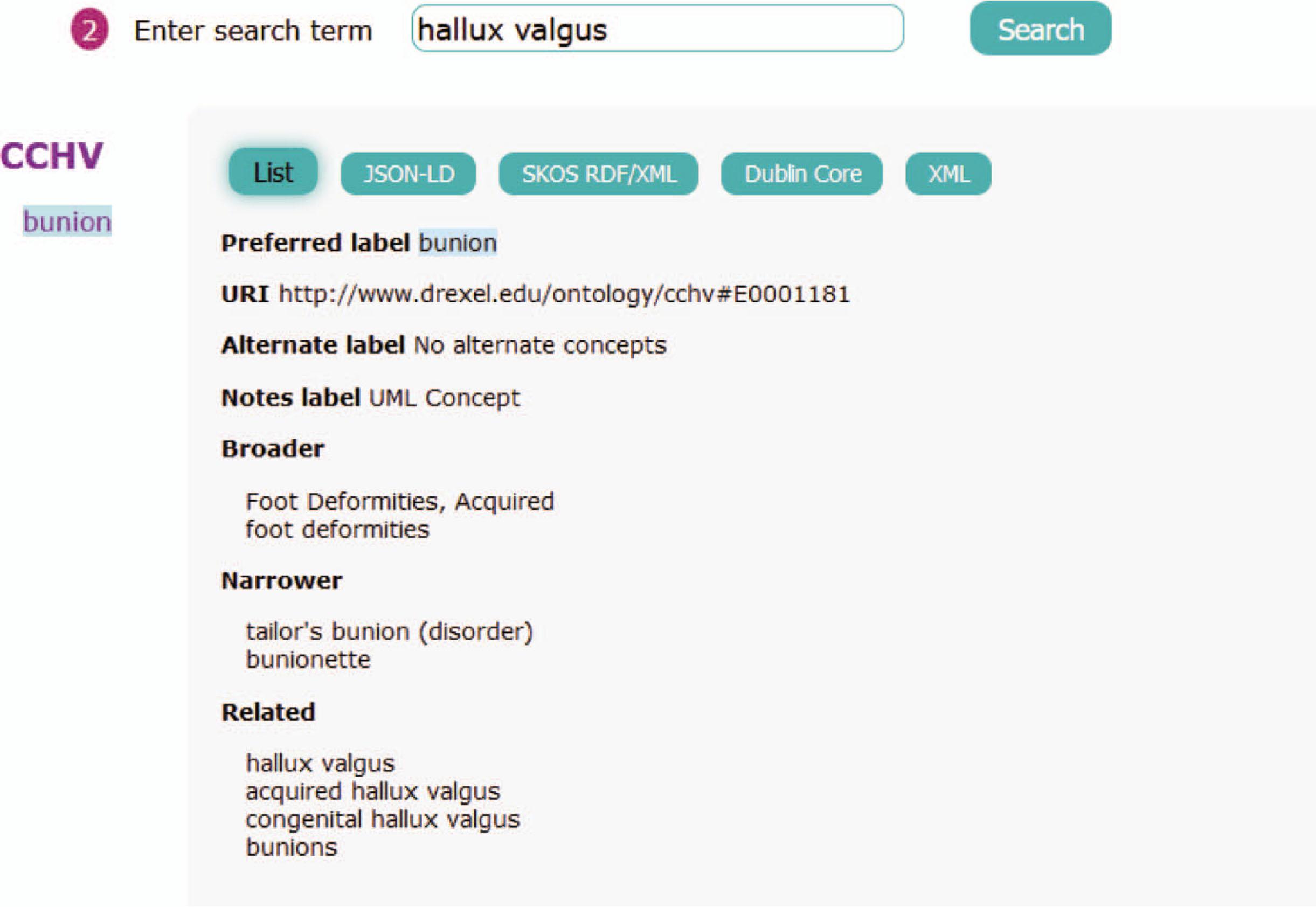 Search results for the term hallux valgus in the improved version of HIVE using CCHV.