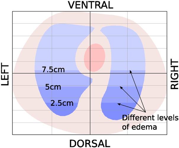 The transverse plane (i.e., imaging plane) of the chest model. The color contrasts of blue in the lung regions represent the levels of edetamous lung injury at 2.5 cm, 5 cm and 7.5 cm.