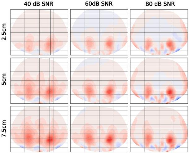 Image reconstructions of the edematous region for different levels of collapse. The rows denote different levels of lung injury.
