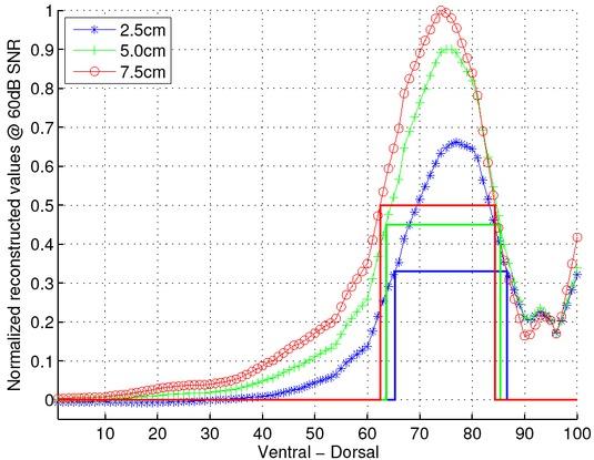 The normalized edema reconstructions along the ventral to dorsal oriented line passing through the peak value of the reconstructions