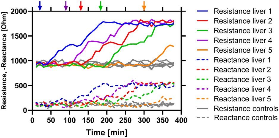 Example of simulated resistance and reactance data at 100kHz for five livers (in colors) having random onsets of ischemia (marked with arrows). Five non-ischemic control livers are added in gray. The data are simulated with a 5% liver variation, no drift, and a noise level of 30 dBW.