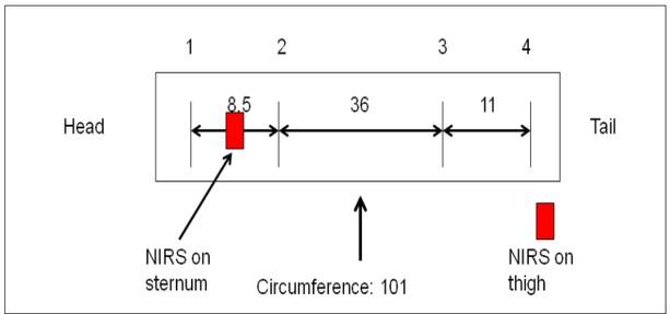 Placement of ECG electrodes for abdominal bioimpedance measurements.