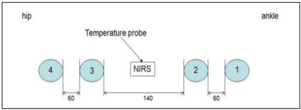 Placement of ECG electrodes for leg bioimpedance measurements.
