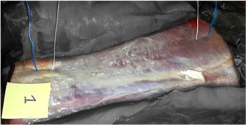 The picture shows the trimmed portion of a right longissimus dorsi muscle from one of the considered animals (285 kg in weight), which was freed from other muscular structures adjacent to it, and was oriented with its rostral head to the upper right. The two external wires are the current injection electrodes and the two internal wires are the electrodes to detect the voltage difference during test number 1 undertaken at the 2nd day post-slaughter.