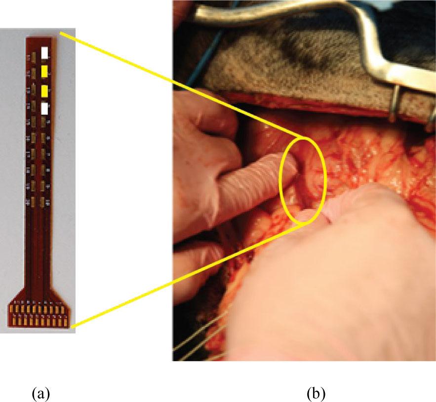 Electrode placement. (a) is the electrode array that is described in section IIA, and shown in Fig. 2. Four total electrodes are used. The top and bottom white electrodes are H_CUR and L_CUR and are connected to ground electrodes, while the center yellow electrodes are H_POT and L_POT, the sense electrodes. (b) The electrode array is manually applied to the tissue for measurements.