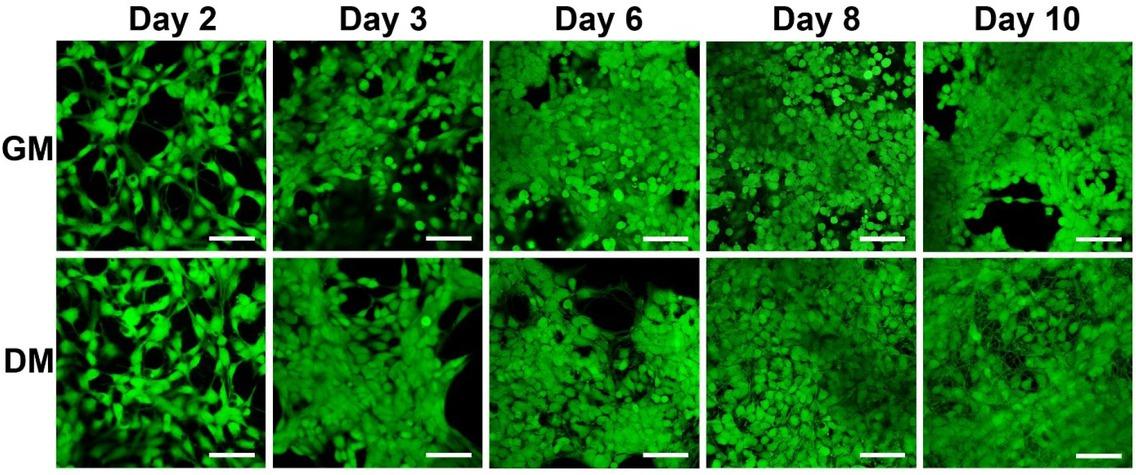 Fluorescence microscopy images of live stained (Calcein AM) hVM1 Bcl-XL cells in growth medium (GM) and differentiation medium (DM). Initial cell density 120,000 cells/cm2. Time in days after cell seeding. (Scale bars: 50 μm)
