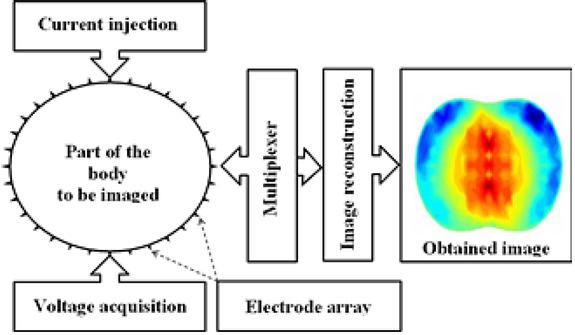 Main parts of an EIT imaging system.