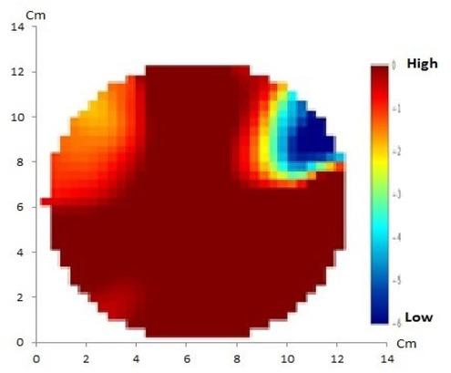 GREIT method with 32 electrodes of artificial solid tumor shows a match between the reconstructed image and the original object containing two anomalies.